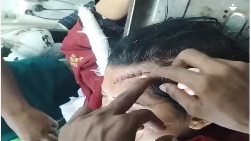 চৌগাছায় জমিজমা সংক্রান্ত বিরোধ সংঘর্ষে ৩ নারী আহত 